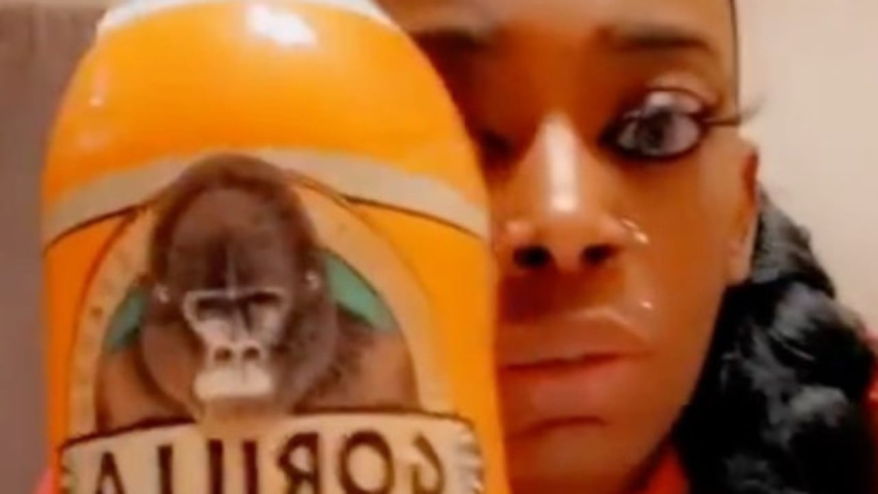 Bunnings Gorilla Glue girl finally gets hair unstuck with surgery