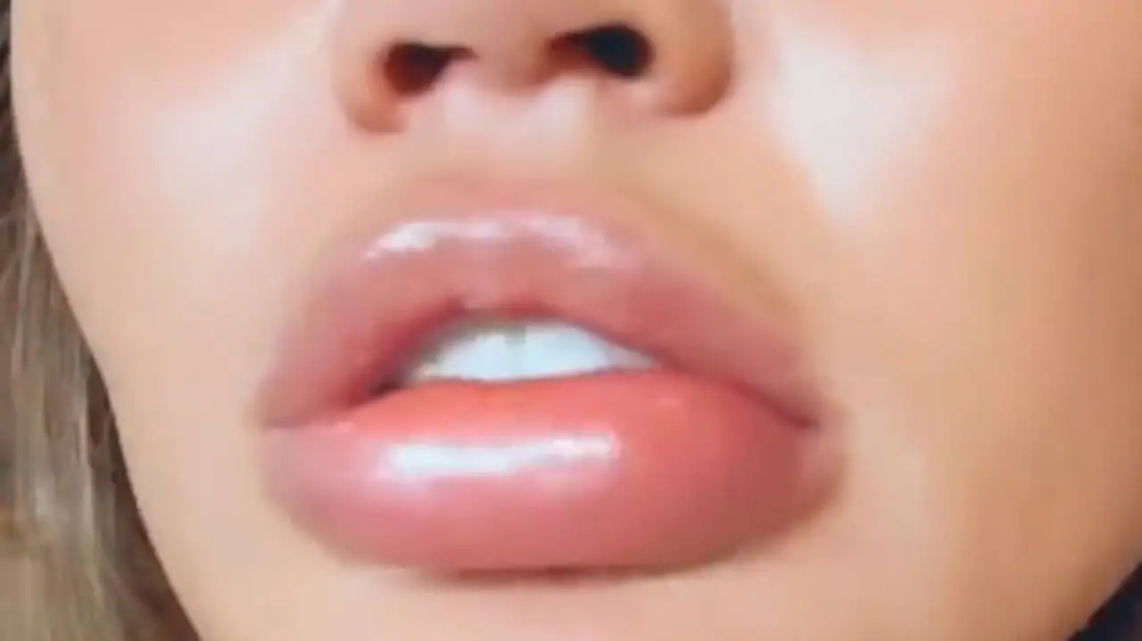 Chrissy Teigen blames orange for majorly swollen lips