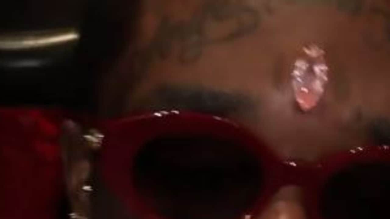 Rapper Lil Uzi gets $31 million diamond implant in forehead