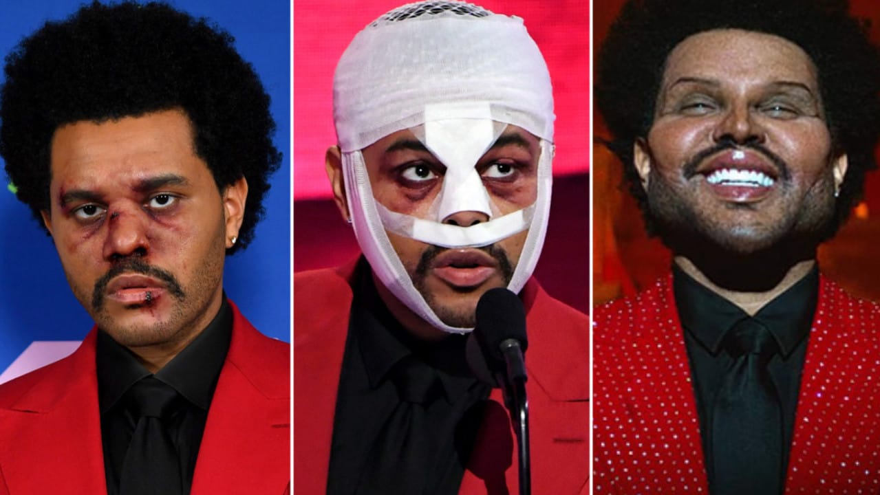 Super Bowl LV performer explains face surgery stunt