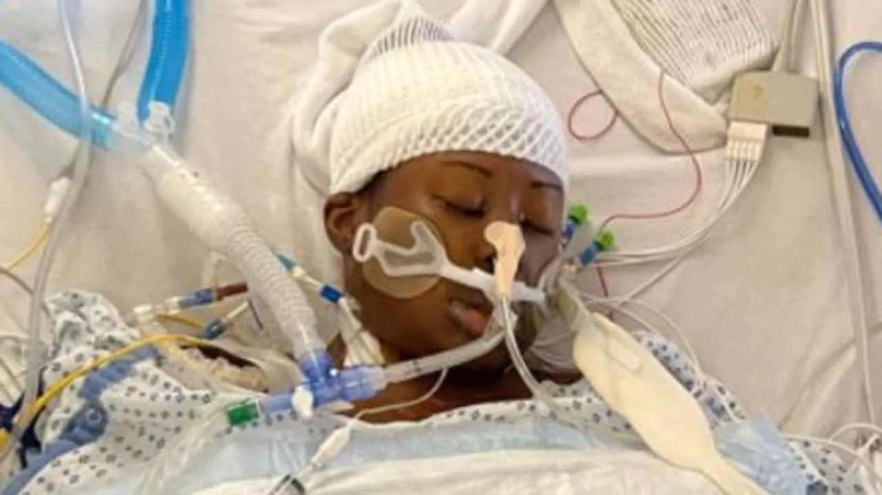 Woman nearly dies from infection in nose piercing