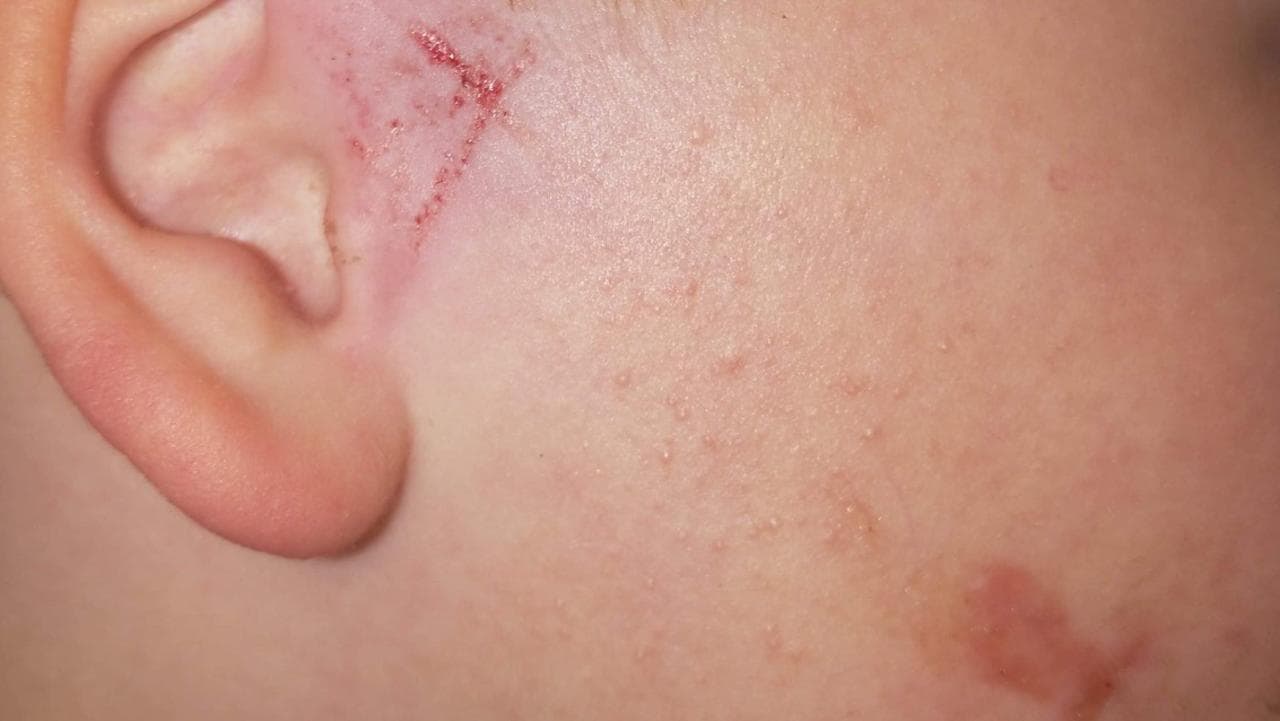Boy injures himself at Delacombe store