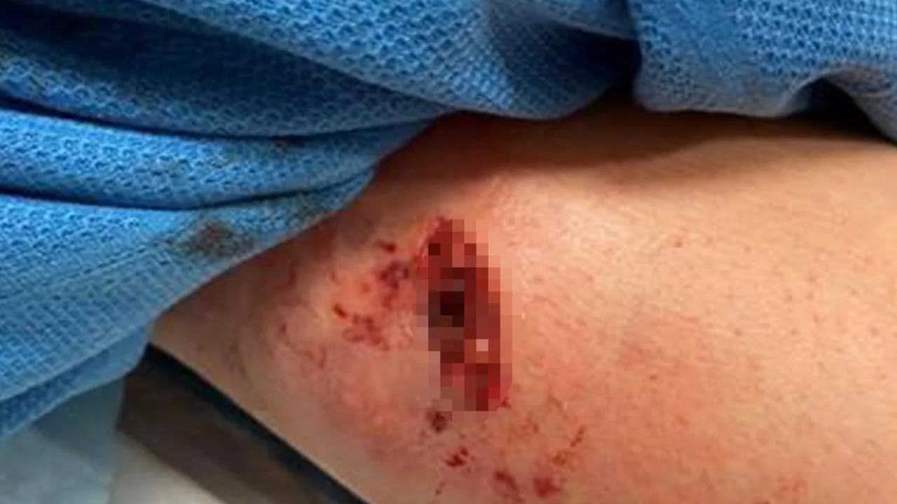 NSW Police officer suffers ‘serious leg injuries’ in dog attack